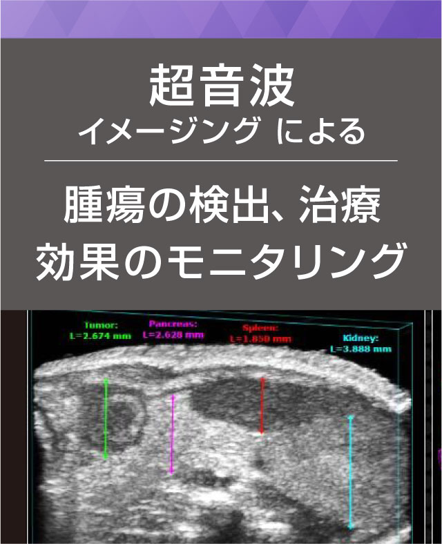高解像度超音波イメージングによる腫瘍の検出・治療効果のモニタリング