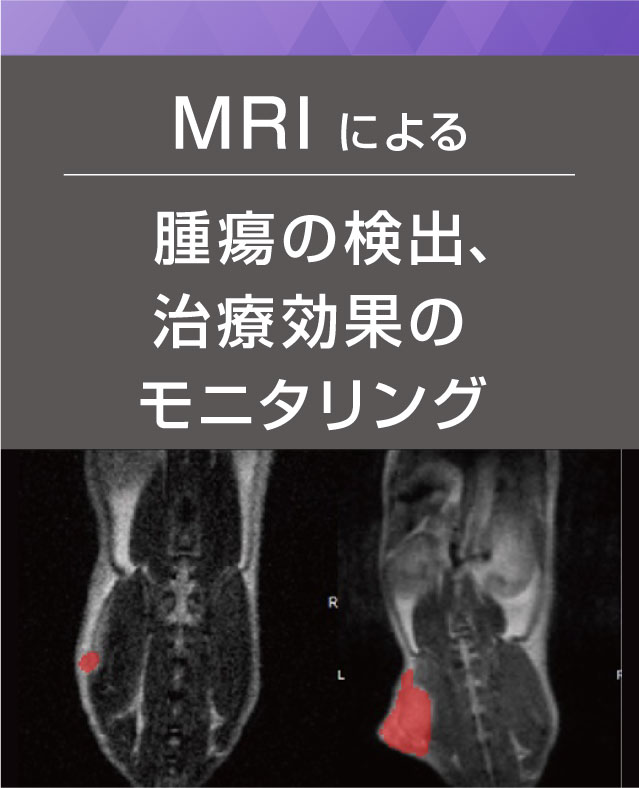 MRIによる腫瘍の検出、治療効果のモニタリング