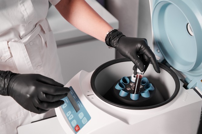 血液分析・試料前処理